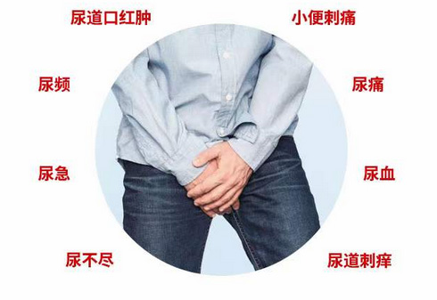 男性尿道炎症吃什么药