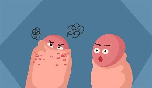 男阴部长小疙瘩不疼不痒什么原因