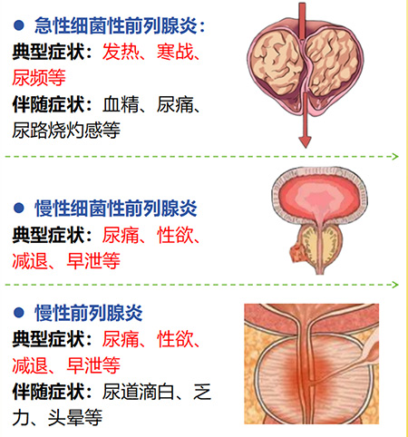 扬州看前列腺炎哪里好