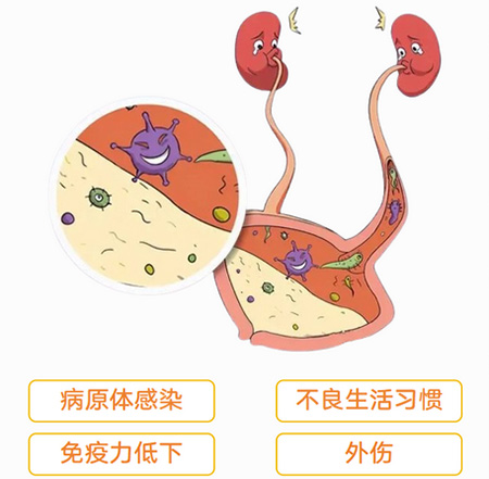 尿道炎是什么原因引起的