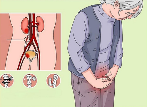 尿道炎怎么治疗才能彻底除根