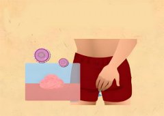 男性hpv病毒怎么才能彻底清除