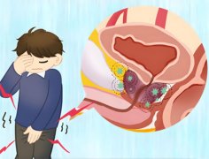 男性前列腺炎能过夫妻生活吗
