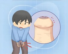  包皮上面长小疙瘩怎么回事