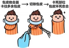 40岁男人割皮有必要割吗