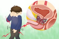 前列腺炎会影响性功能吗