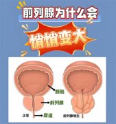 前列腺增大是怎么回事，需要治疗吗