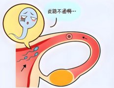 输精管堵塞如何治疗方法男士