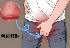 包皮发炎红肿是什么原因