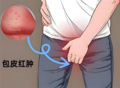 包皮红肿一圈怎么回事