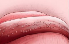 男性外皮长了很多小颗粒不痛不痒怎么办