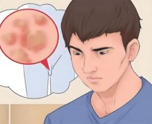 hpv病毒男性会感染吗?