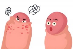 男的毛里长痘痘怎么回事