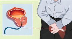 前列腺炎会传染给妻子吗