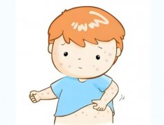 hpv是怎么感染上的原因是什么