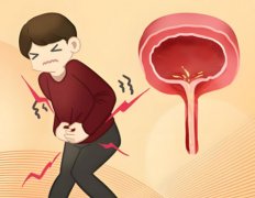 尿路感染可以同房吗