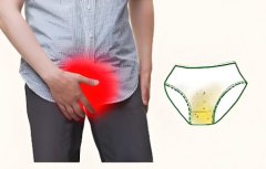 男性尿道口流脓内裤上黄黄的