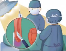 割包皮必须割吗