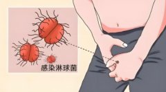 男性感染性病的早期症状