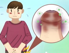 龟 头上有红肿痛怎么治疗