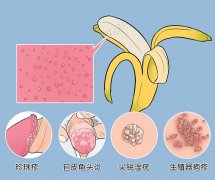 男性生殖器上有小颗粒是什么 