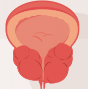 前列腺肥大患者能喝酒吗