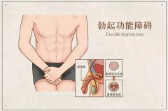 勃起功能障碍症状是什么